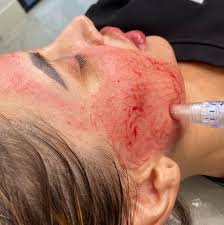 Hydration, Texture, and Results: Comparing Gel and Cream Masks